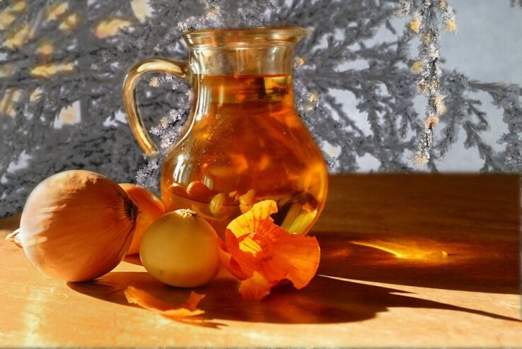 hagymafőzet prosztatagyulladásra